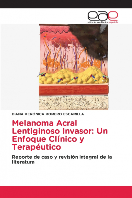 Melanoma Acral Lentiginoso Invasor