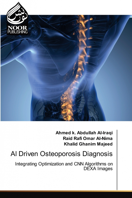 AI Driven Osteoporosis Diagnosis