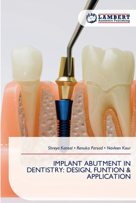 IMPLANT ABUTMENT IN DENTISTRY