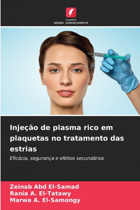 Injeção de plasma rico em plaquetas no tratamento das estrias