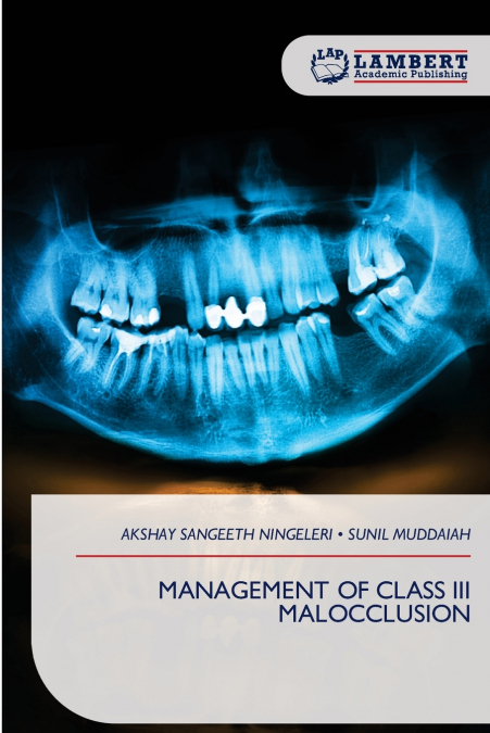 MANAGEMENT OF CLASS III MALOCCLUSION