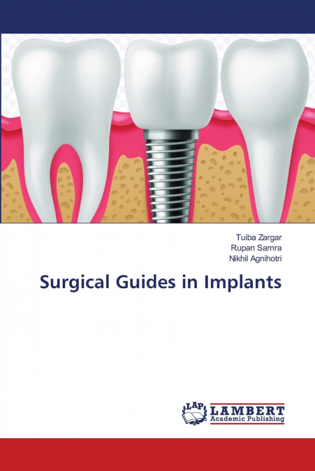 Surgical Guides in Implants