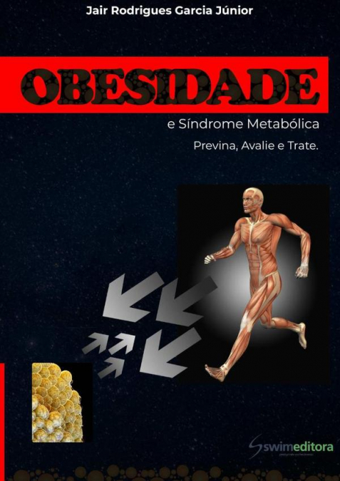 Obesidade E Síndrome Metabólica