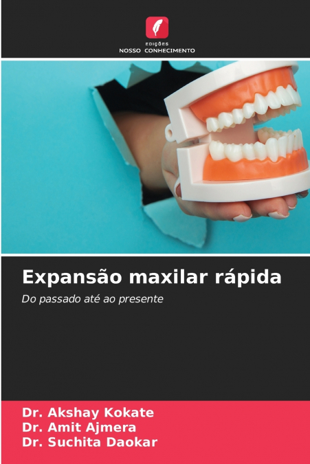 Expansão maxilar rápida
