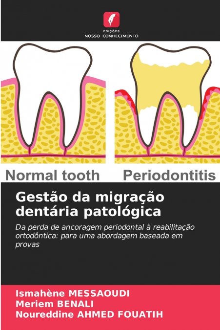 Gestão da migração dentária patológica