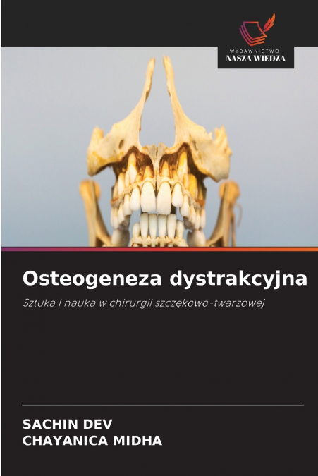 Osteogeneza dystrakcyjna