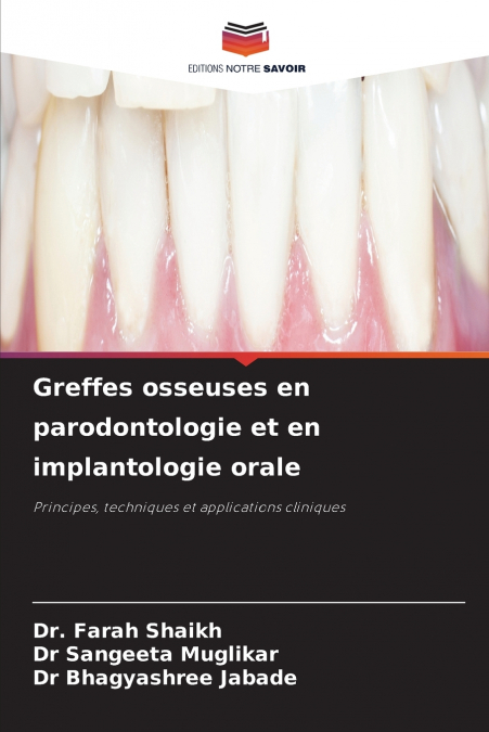 Greffes osseuses en parodontologie et en implantologie orale