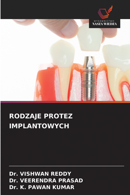RODZAJE PROTEZ IMPLANTOWYCH