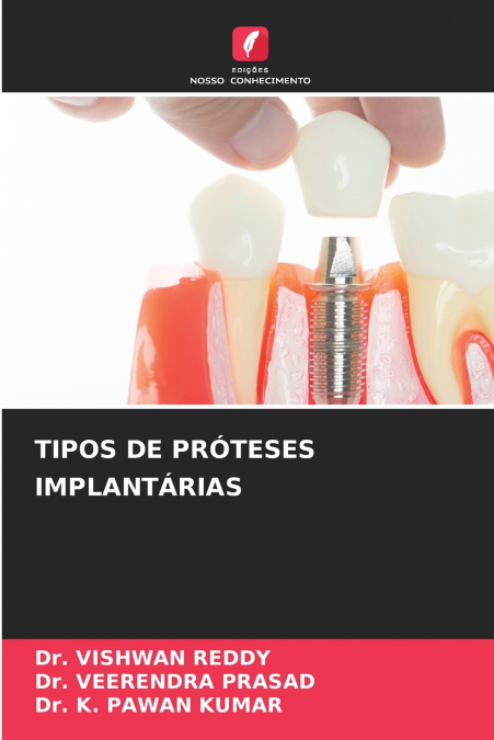 TIPOS DE PRÓTESES IMPLANTÁRIAS