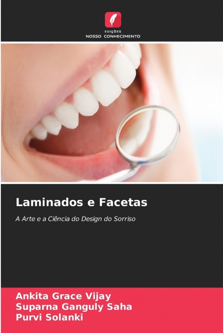 Laminados e Facetas