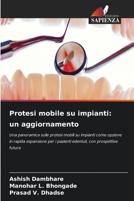 Protesi mobile su impianti