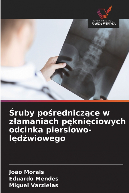 Śruby pośredniczące w złamaniach pęknięciowych odcinka piersiowo-lędźwiowego
