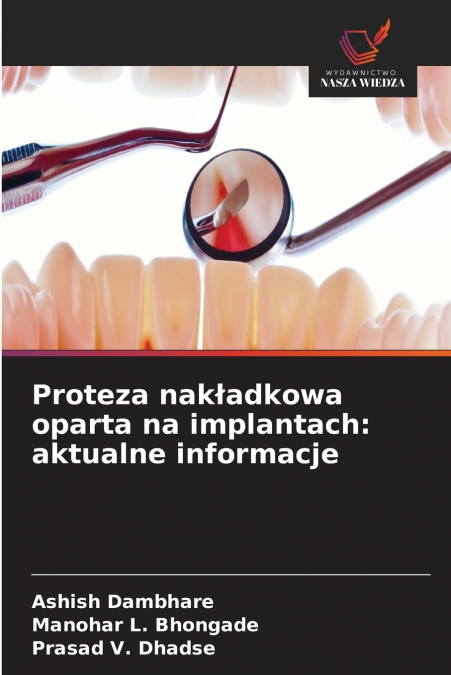 Proteza nakładkowa oparta na implantach