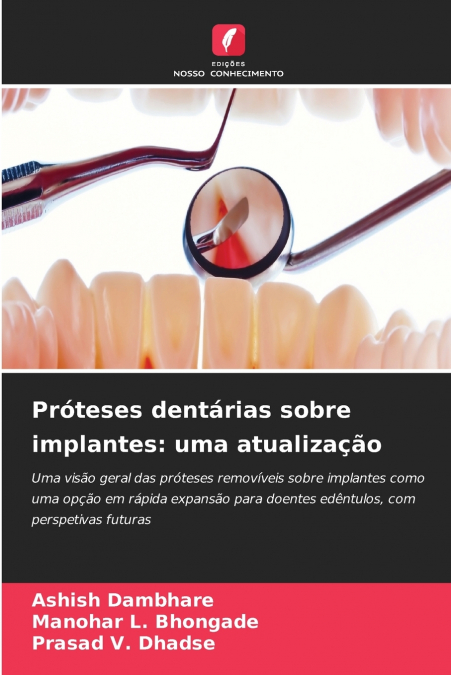 Próteses dentárias sobre implantes
