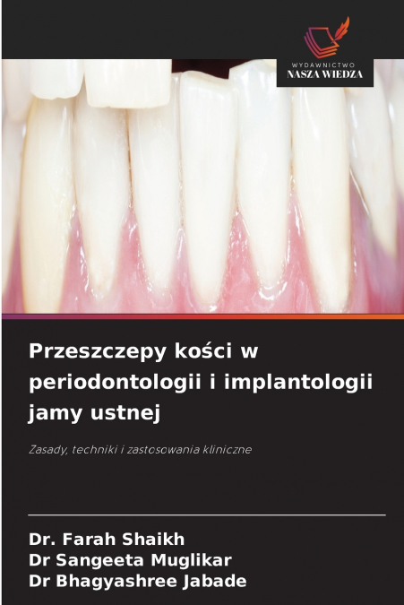 Przeszczepy kości w periodontologii i implantologii jamy ustnej