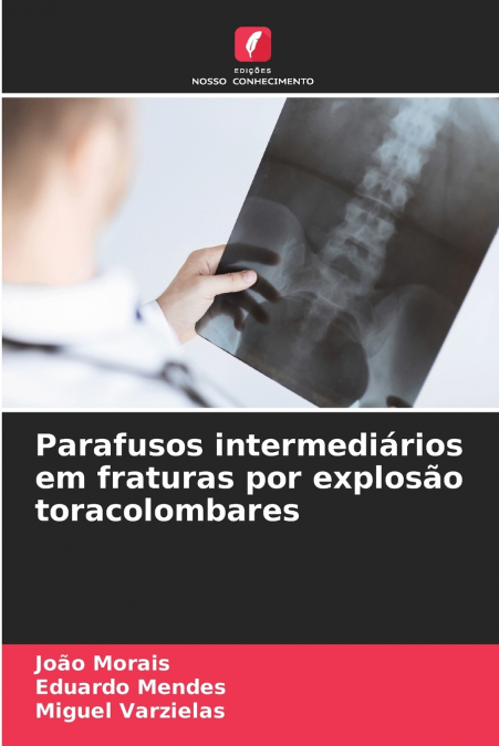Parafusos intermediários em fraturas por explosão toracolombares