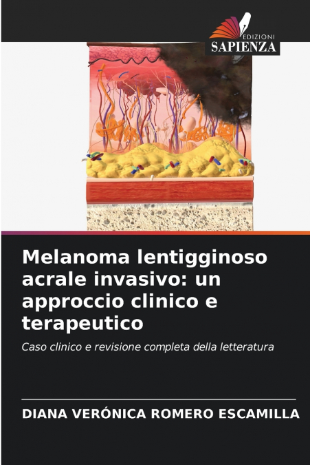 Melanoma lentigginoso acrale invasivo