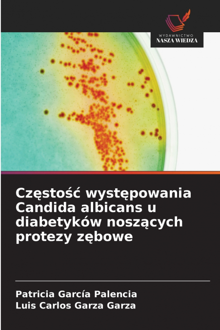 Częstość występowania Candida albicans u diabetyków noszących protezy zębowe