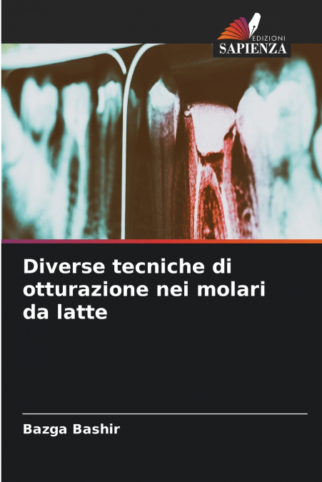 Diverse tecniche di otturazione nei molari da latte