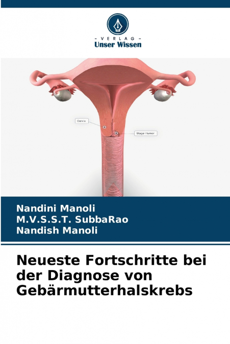 Neueste Fortschritte bei der Diagnose von Gebärmutterhalskrebs