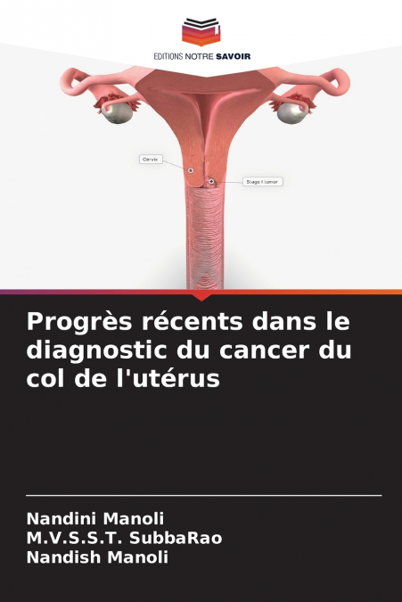 Progrès récents dans le diagnostic du cancer du col de l’utérus