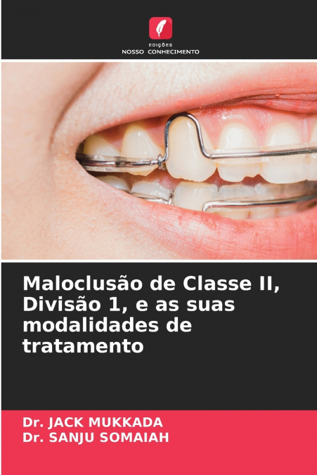 Maloclusão de Classe II, Divisão 1, e as suas modalidades de tratamento