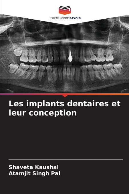 Les implants dentaires et leur conception