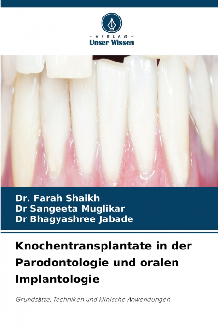 Knochentransplantate in der Parodontologie und oralen Implantologie