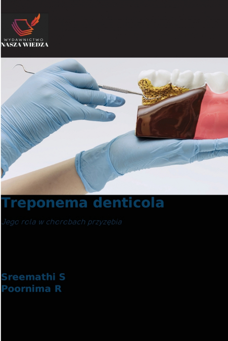 Treponema denticola
