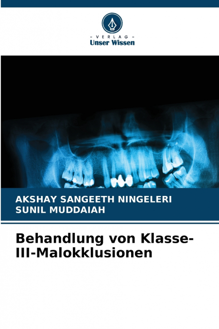 Behandlung von Klasse-III-Malokklusionen