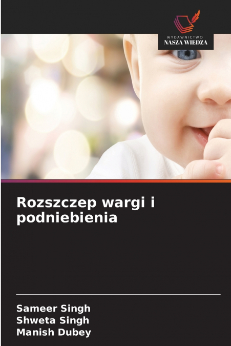 Rozszczep wargi i podniebienia