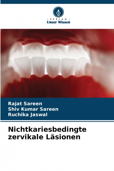 Nichtkariesbedingte zervikale Läsionen
