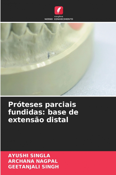 Próteses parciais fundidas