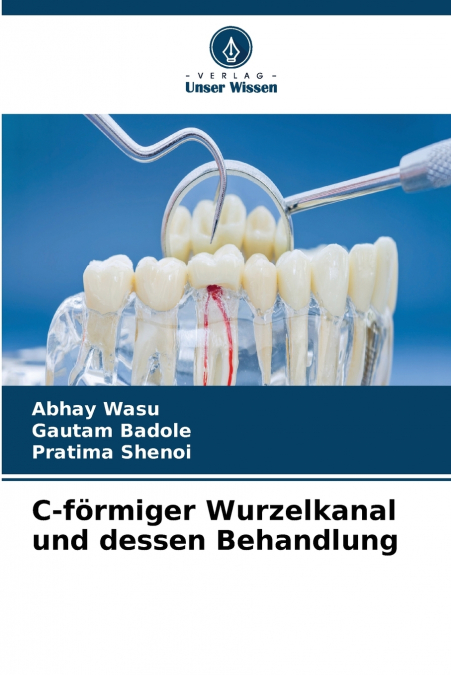 C-förmiger Wurzelkanal und dessen Behandlung