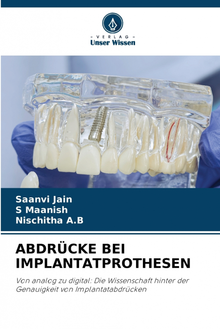 ABDRÜCKE BEI IMPLANTATPROTHESEN