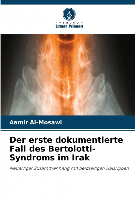 Der erste dokumentierte Fall des Bertolotti-Syndroms im Irak
