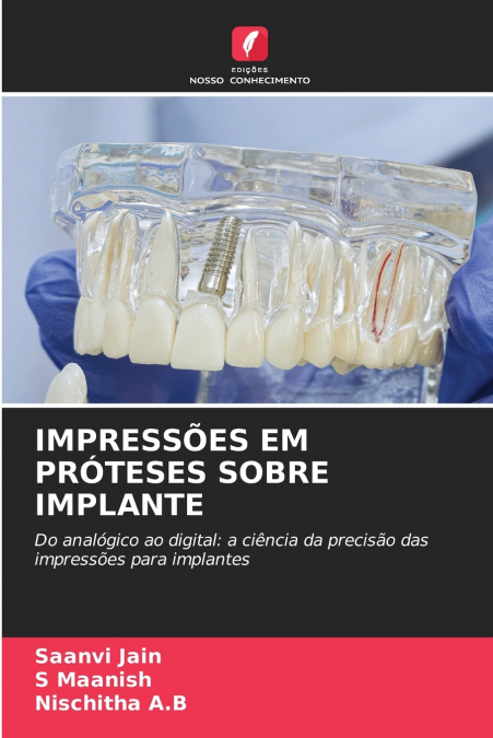 IMPRESSÕES EM PRÓTESES SOBRE IMPLANTE