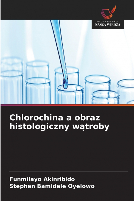 Chlorochina a obraz histologiczny wątroby
