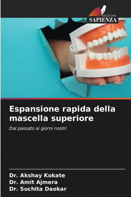 Espansione rapida della mascella superiore