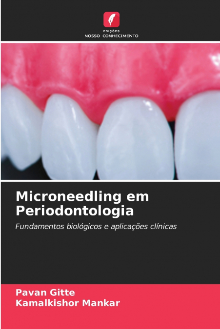 Microneedling em Periodontologia