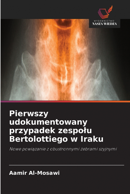 Pierwszy udokumentowany przypadek zespołu Bertolottiego w Iraku