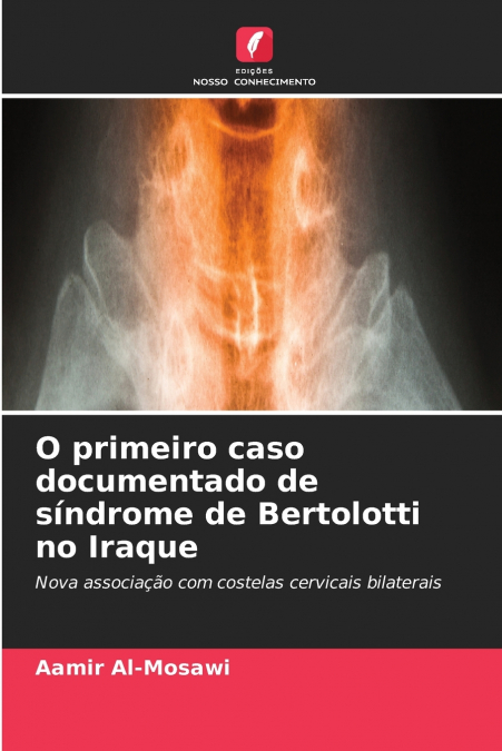 O primeiro caso documentado de síndrome de Bertolotti no Iraque