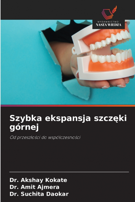 Szybka ekspansja szczęki górnej