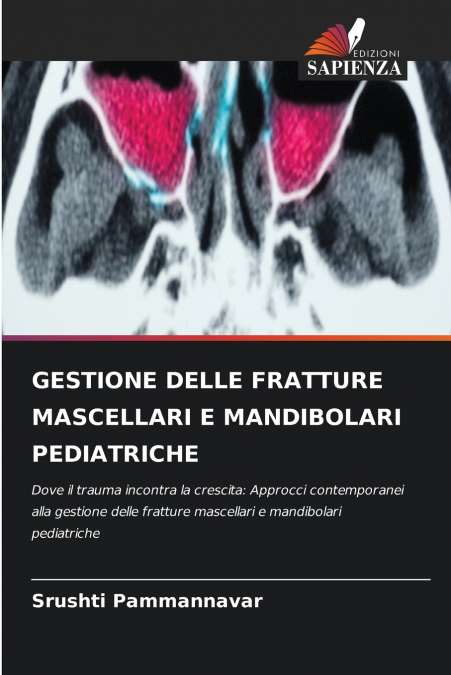 GESTIONE DELLE FRATTURE MASCELLARI E MANDIBOLARI PEDIATRICHE