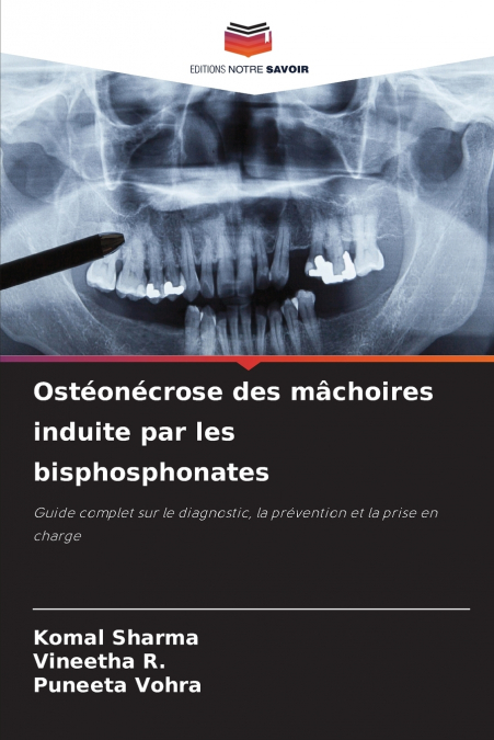 Ostéonécrose des mâchoires induite par les bisphosphonates