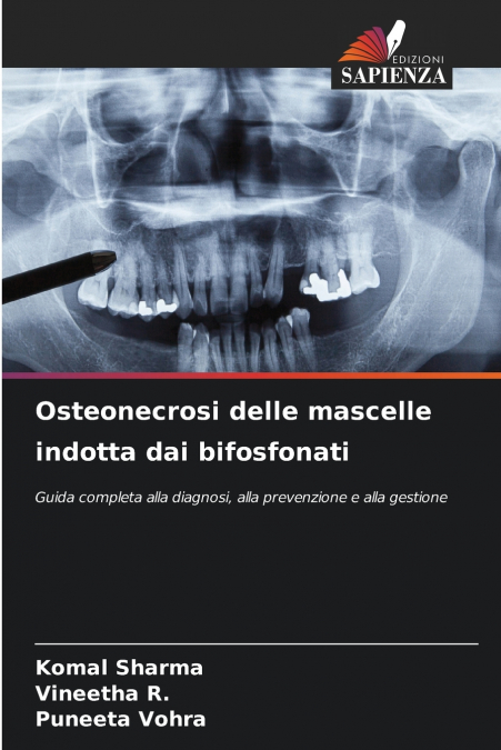 Osteonecrosi delle mascelle indotta dai bifosfonati