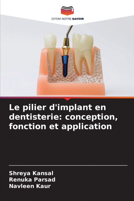 Le pilier d’implant en dentisterie