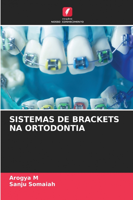 SISTEMAS DE BRACKETS NA ORTODONTIA