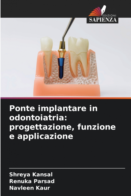 Ponte implantare in odontoiatria