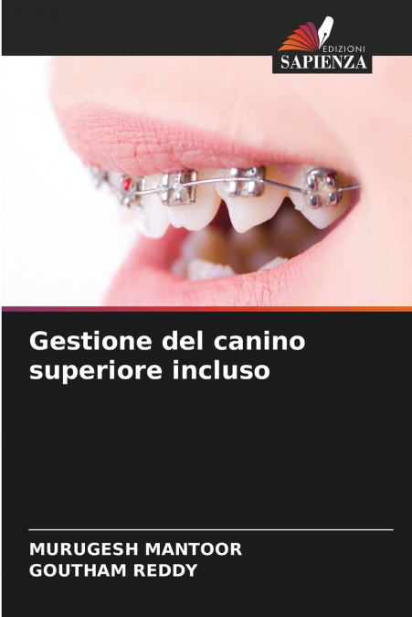 Gestione del canino superiore incluso